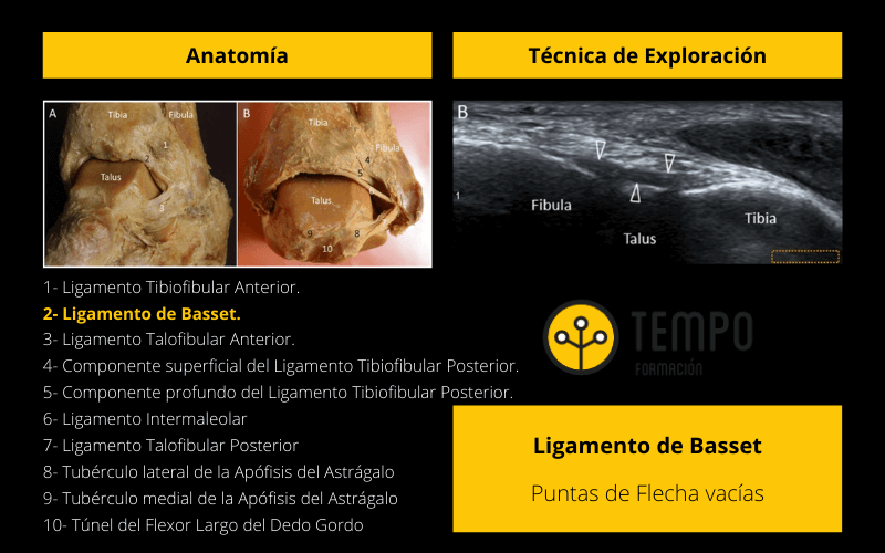 Ligamento de Basset.png